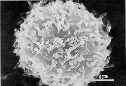 Human Lymphocyte with Osmium metal